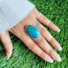 Azurite Malachite Ring Ring-331